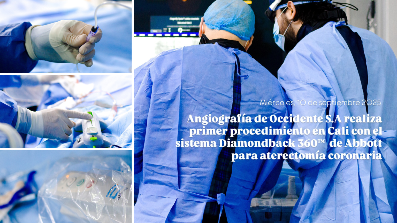 Angiografía de Occidente S.A. realiza primer procedimiento en Cali con sistema DiamondBack 360 DE Abbott para aterectomía coronaria